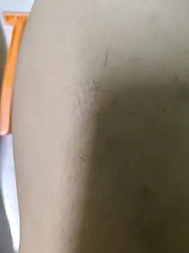 Snapshot of Miky_Lyn chatting on March 2, 2026, 4:25 pm Miky Lyn online show from March 2, 2026, 4:25 pm